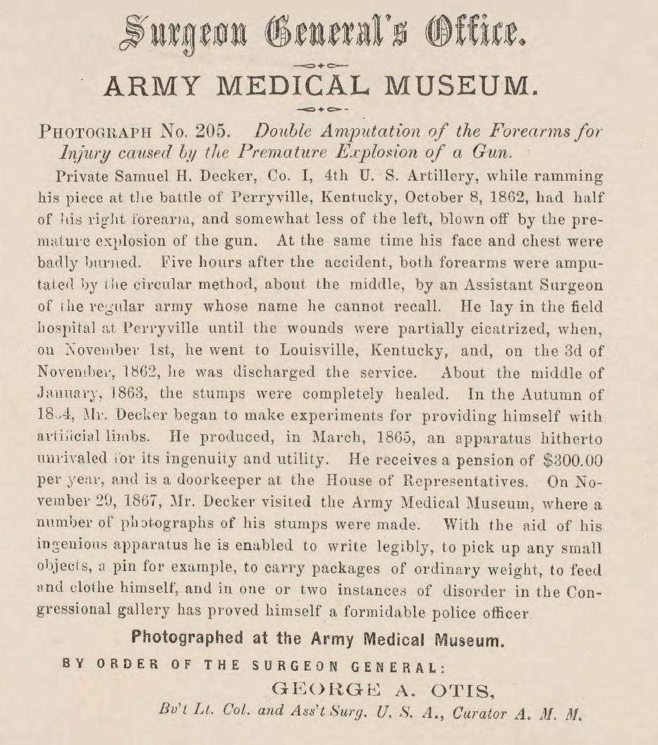 Civil War U.S. Surgeon General Photographs of Surgical Cases and Specimens Sample page 6